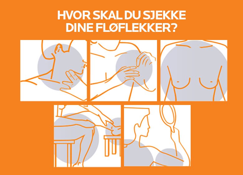 LRP_NO_SAVE_CHECK_YOUR_MOLES_BANNER_780x560px