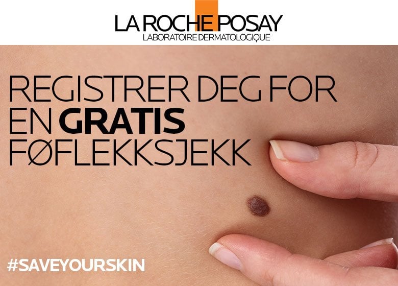 Sjekke Foflekker Gratis () Sjekke Foflekker Gratis